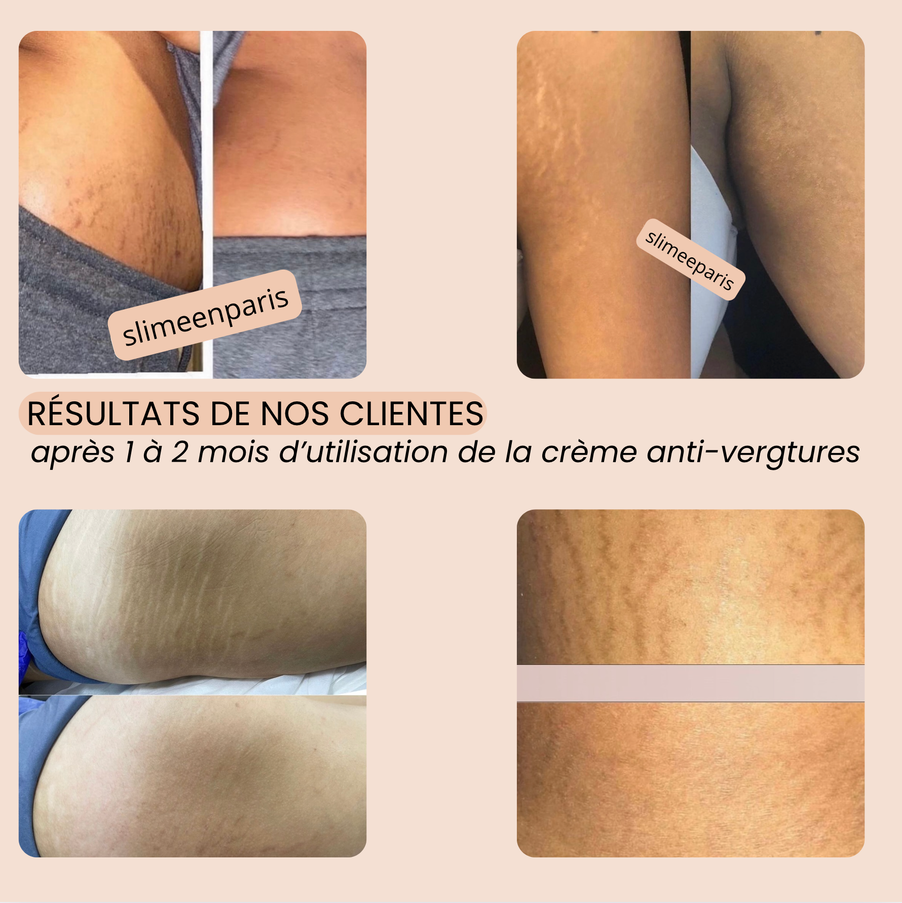 SLIM CREAM - Crème réparatrice anti-vergetures